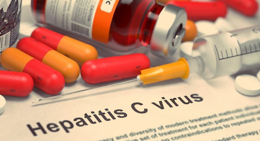 C ჰეპატიტის ელიმინაციის პროგრამას სუს-ი სწავლობს