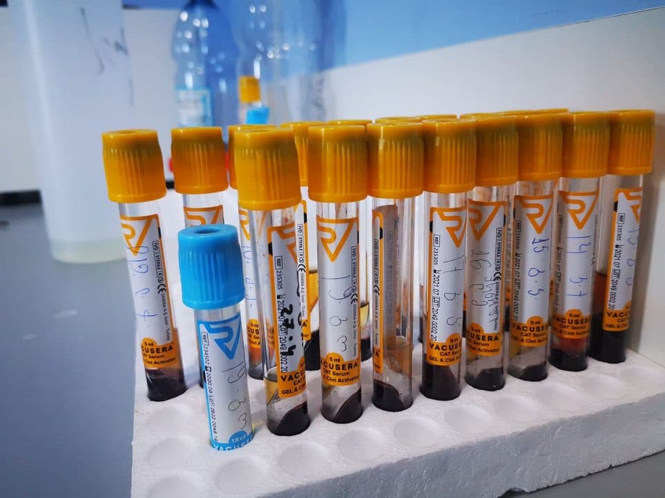 ინფექციური საავადმყოფოს ლაბორატორიაში ხვალიდან COVID-ზე მედიკოსების გამოკვლევა დაიწყება