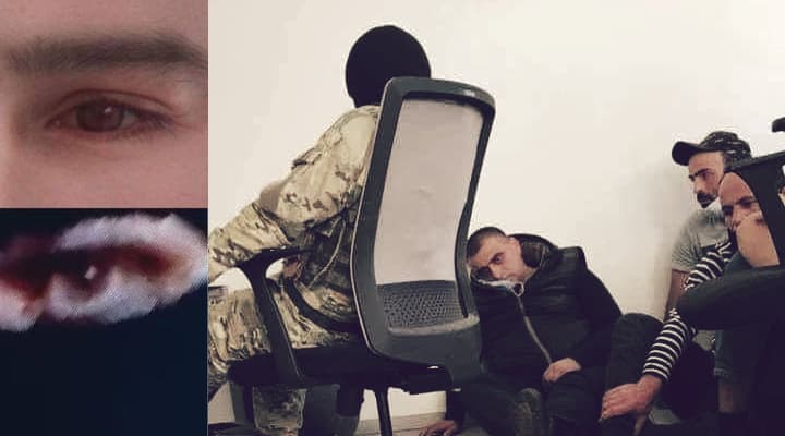 ბადრი ესებუას ოჯახში აცხადებენ რომ ის უდანაშაულოა და თბილისში ავადმყოფობის გამო იმყოფება