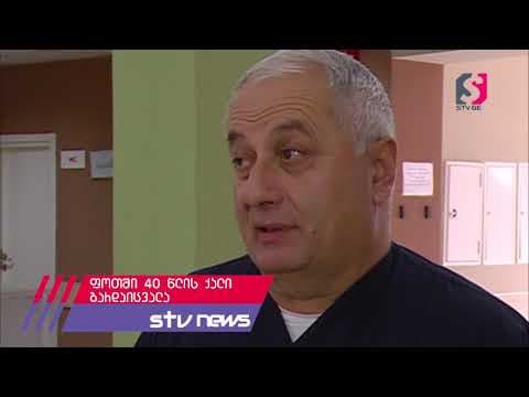 ფოთში 40 წლის ქალი მწვავე რესპირატორული ინფექციით გარდაიცვალა