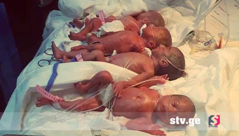 25 წლის ერაყელმა ქალმა ექვსი გოგო და ერთი ბიჭი გააჩინა