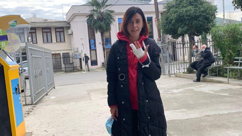 წითლიძემ “მონებო”-ს წერისას თითი მოიტეხა